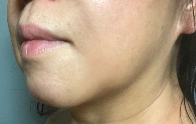 �ق��ꂢ���̂Ȃ�����